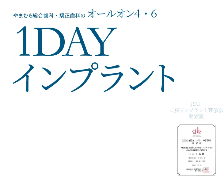 やまむら総合歯科・矯正歯科のオールオン４・６